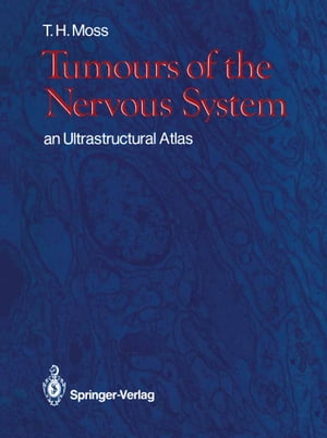 Tumours of the Nervous System