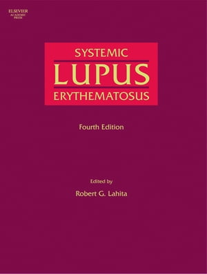 Systemic Lupus Erythematosus