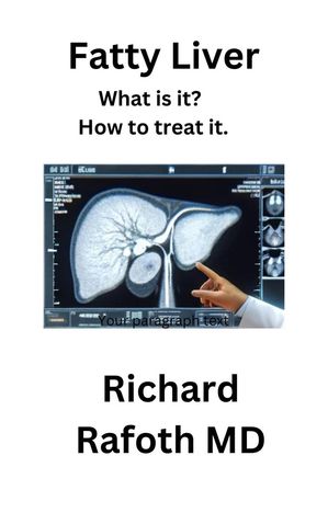 ŷKoboŻҽҥȥ㤨Fatty Liver - What is it?Żҽҡ[ Richard Rafoth MD ]פβǤʤ200ߤˤʤޤ