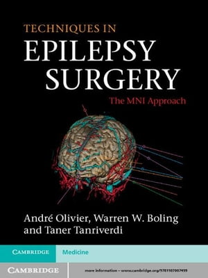 ŷKoboŻҽҥȥ㤨Techniques in Epilepsy Surgery The MNI ApproachŻҽҡ[ Andr? Olivier ]פβǤʤ24,035ߤˤʤޤ