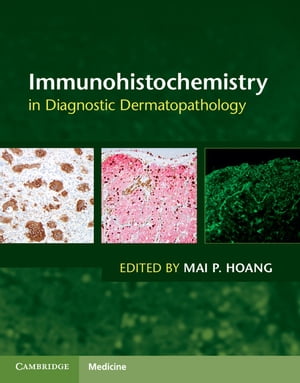 Immunohistochemistry in Diagnostic Dermatopathology【電子書籍】