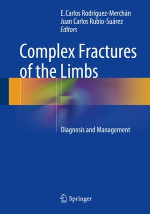 Complex Fractures of the Limbs Diagnosis and Management【電子書籍】