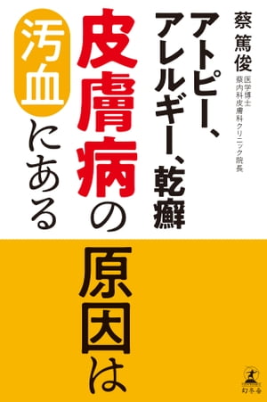 ＜p＞日本で2人に1人がアレルギーをもっていると言われる現在。＜br /＞ 病気にならず健康に生きていくための基本から、症状改善のための具体的な方法までを専門家が解説。＜br /＞ 皮膚病に悩むすべての人のための一冊。＜/p＞ ＜p＞【目次抜粋】＜br /＞ はじめに＜/p＞ ＜p＞第1章 皮膚病はなぜ起きるのか＜br /＞ ●皮膚の異常は体からの要注意信号＜br /＞ ●なぜアレルギー疾患は起きるのか＜br /＞ ●毒に囲まれて生きている現代人＜/p＞ ＜p＞第2章 皮膚病の種類＜br /＞ ●アトピー性皮膚炎と気管支喘息は親戚関係＜br /＞ ●ニキビ＜br /＞ ●ハゲも乾癬も食生活の乱れが招く＜/p＞ ＜p＞第3章 西洋医学、ステロイド剤の落とし穴＜br /＞ ●化学薬品では病気は治せない＜br /＞ ●手術に頼る西洋医学＜br /＞ ●かゆい皮膚病はかいていい＜/p＞ ＜p＞第4章 皮膚病の最善の治療は汚血を取ること＜br /＞ ●自然に毒を出している＜br /＞ ●汚血がたまっているサインとは＜br /＞ ●皮膚病を治す7つの鉄則＜/p＞ ＜p＞第5章 漢方薬はなぜ皮膚病に効果があるのか＜br /＞ ●医学の基礎は薬草＜br /＞ ●化学薬品と漢方薬の違い＜br /＞ ●尋常性乾癬が35種類の薬草で改善＜/p＞ ＜p＞第6章 体に「毒」をためない生活＜br /＞ ●病気にならないための7ヵ条＜br /＞ ●平均寿命ではなく、健康寿命を延ばす＜br /＞ ●希望をもち続け、病気を気にしない＜/p＞画面が切り替わりますので、しばらくお待ち下さい。 ※ご購入は、楽天kobo商品ページからお願いします。※切り替わらない場合は、こちら をクリックして下さい。 ※このページからは注文できません。