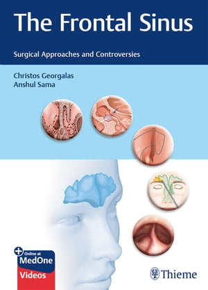 The Frontal Sinus