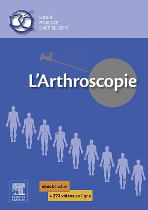 L'arthroscopie