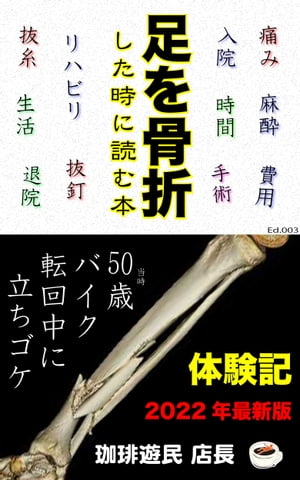 足を骨折した時に読む本 バイクを足漕ぎで転回中にコケて右足をL字に粉砕骨折をしてから完治までの体験記【電子書籍】[ 珈琲遊民店長 ]