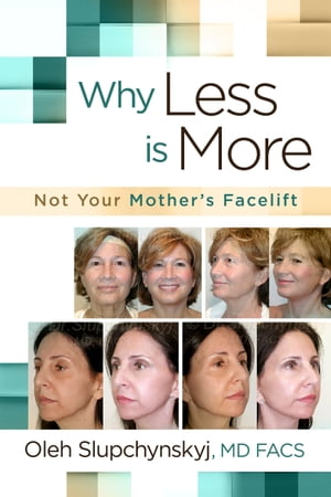 Why Less Is More Not Your Mother's Facelift【電子書籍】[ Oleh Slupchynskyj, MD FACS ] 1