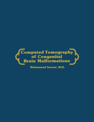 Computed Tomography of Congenital Brain Malformations