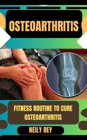 OSTEOARTHRITIS