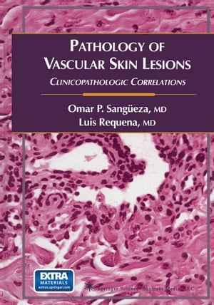 Pathology of Vascular Skin Lesions