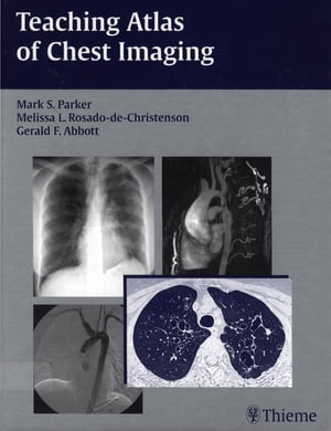 Teaching Atlas of Chest Imaging【電子書籍】[ Mark S. Parker ]