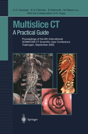 Multislice CT A Practical Guide Proceedings of the 6th International SOMATOM CT Scientific User Conference Tuebingen, September 2002Żҽҡ[ A. Kopp ]