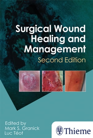 Surgical Wound Healing and Management