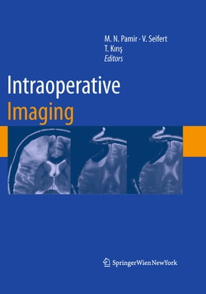 Intraoperative ImagingŻҽҡ