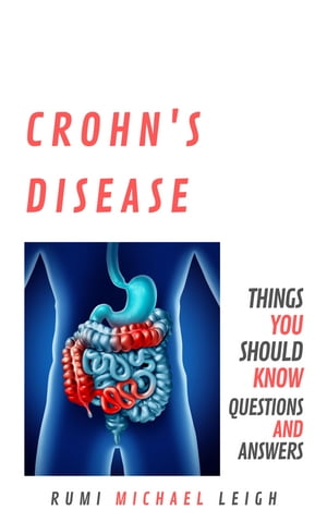 Crohn's Disease