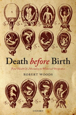 Death before Birth