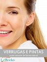 Verrugas e pintas Como remover de forma natural