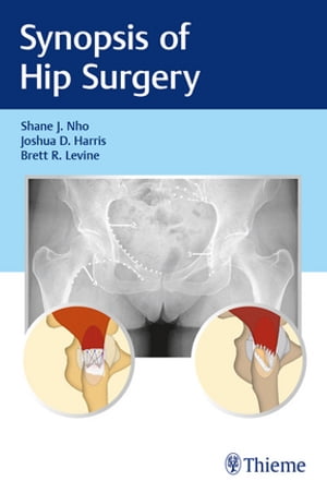 Synopsis of Hip Surgery