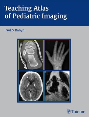Teaching Atlas of Pediatric Imaging