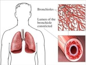 Aspergillosis: Causes, Symptoms and Treatments