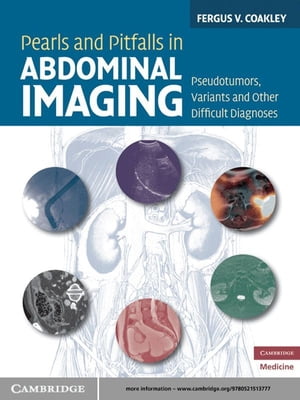 楽天楽天Kobo電子書籍ストアPearls and Pitfalls in Abdominal Imaging Pseudotumors, Variants and Other Difficult Diagnoses【電子書籍】[ Fergus V. Coakley, MD ]