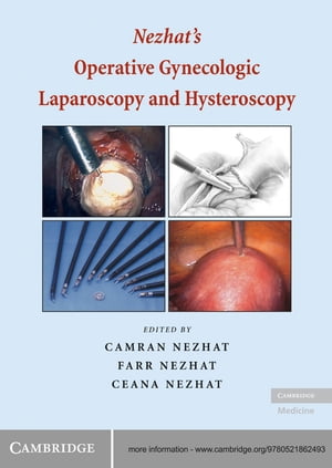 Nezhat's Operative Gynecologic Laparoscopy and Hysteroscopy