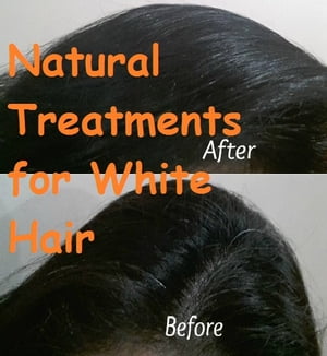 Natural Treatments for White Hair