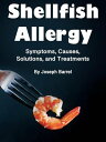 ŷKoboŻҽҥȥ㤨Shellfish Allergy Symptoms, Causes, Solutions, and TreatmentsŻҽҡ[ Joseph Barrel ]פβǤʤ484ߤˤʤޤ