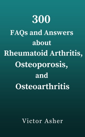 300 FAQs and Answers about Rheumatoid Arthritis, Osteoporosis, and Osteoarthritis