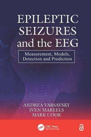 Epileptic Seizures and the EEG