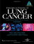 Principles and Practice of Lung Cancer