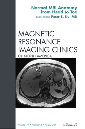 Normal MR Anatomy, An Issue of Magnetic Resonance Imaging Clinics Normal MR Anatomy, An Issue of Magnetic Resonance Imaging Clinics【電子書籍】 Peter S. Liu, MD