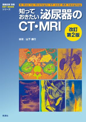 知っておきたい泌尿器のCT・MRI 改訂第2版【電子書籍】[ 山下康行 ]