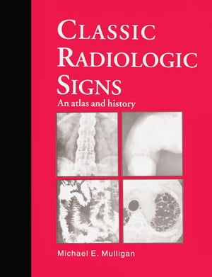 Classic Radiologic Signs