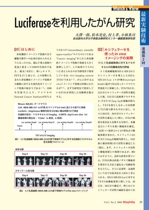 最新実験技術 : 第2回 Luciferaseを利用したがん研究