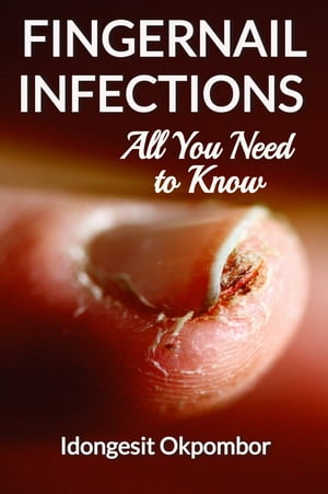 Fingernail Infections