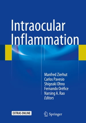 Intraocular InflammationŻҽҡ