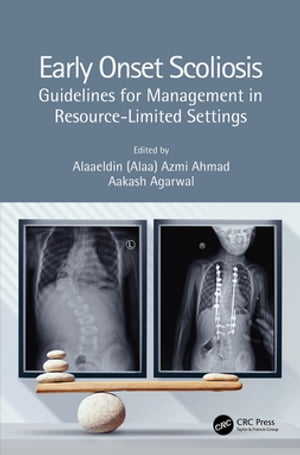 ŷKoboŻҽҥȥ㤨Early Onset Scoliosis Guidelines for Management in Resource-Limited SettingsŻҽҡۡפβǤʤ13,512ߤˤʤޤ