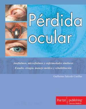 P?RDIDA OCULAR ANOFTALMOS, MICROFTALMOS Y ENFERMEDADES SIMILARES