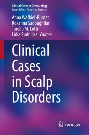 Clinical Cases in Scalp Disorders【電子書籍】