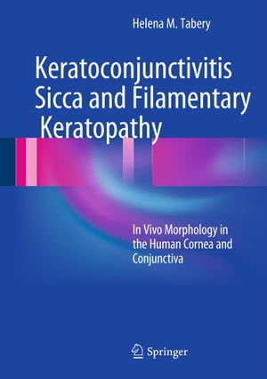 Keratoconjunctivitis Sicca and Filamentary Kerat