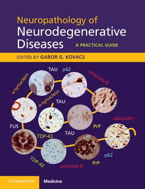 Neuropathology of Neurodegenerative Diseases