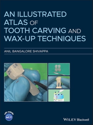 An Illustrated Atlas of Tooth Carving and Wax-Up Techniques【電子書籍】 Anil Bangalore Shivappa