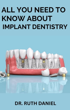 ALL YOU NEED TO KNOW ABOUT IMPLANT DENTISTRY