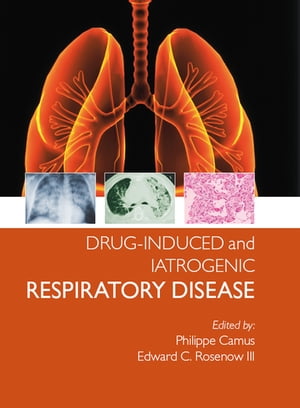 Drug-induced and Iatrogenic Respiratory Disease