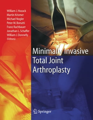Minimally Invasive Total Joint Arthroplasty【電子書籍】