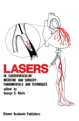 Lasers in Cardiovascular Medicine and Surgery: Fundamentals and Techniques【電子書籍】