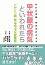 NHK出版 病気がわかる本 甲状腺の病気といわれたら バセドウ病 橋本病 甲状腺腫瘍【電子書籍】 西川光重