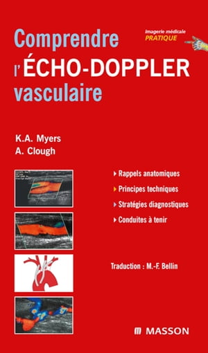 Comprendre l'Echo-Doppler vasculaire