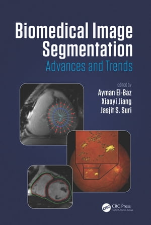 Biomedical Image Segmentation